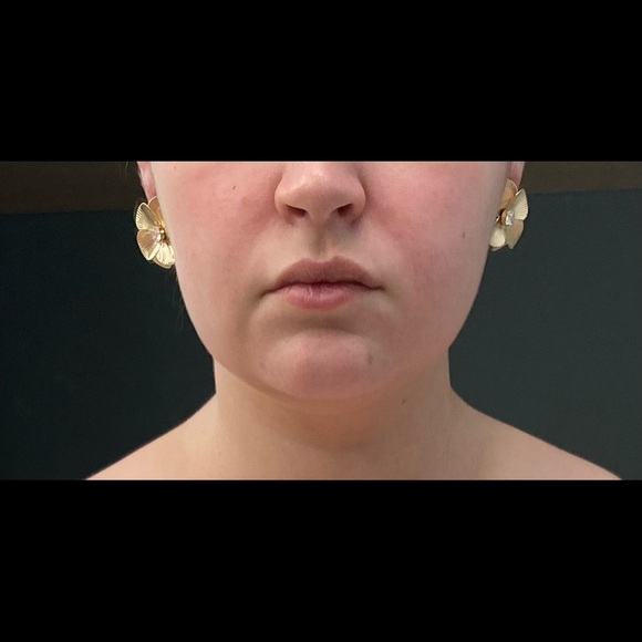 Gold Roses - Picture 3 of 4